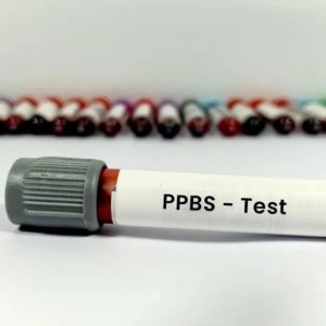 PPBS-Test