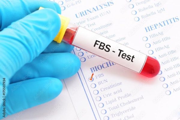 fasting blood sugar test